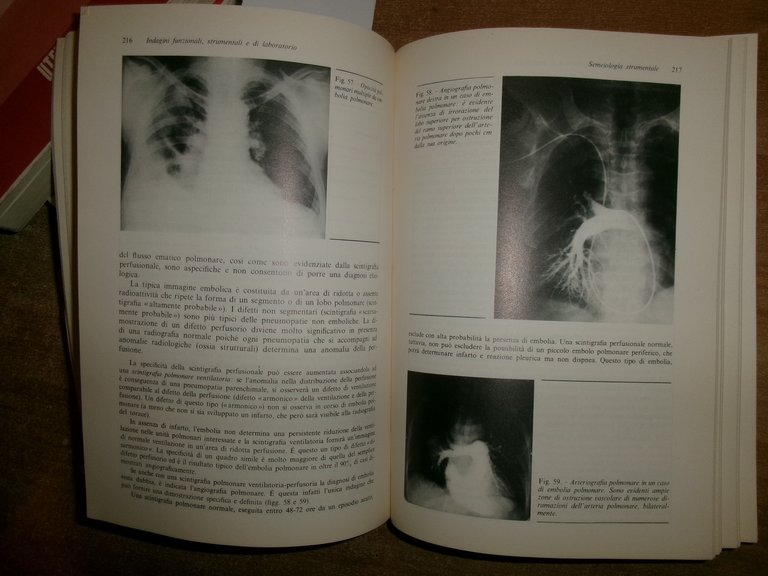 PNEUMOLOGIA. MUIESEN/SORBINI/GRASSI 1982