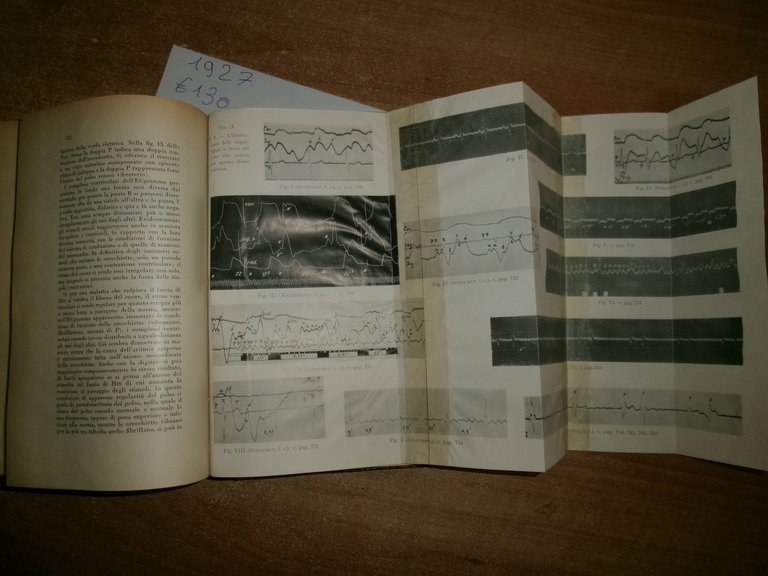 Prof. ANGELO CECONI. Corso di Lezioni Cliniche 1927