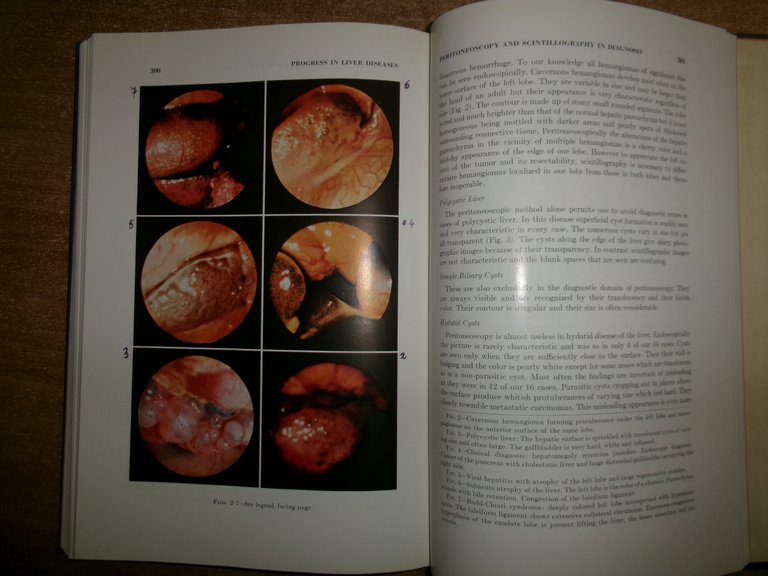 Progress in LIVER DISEASES volume I. HANS POPPER e FENTON …