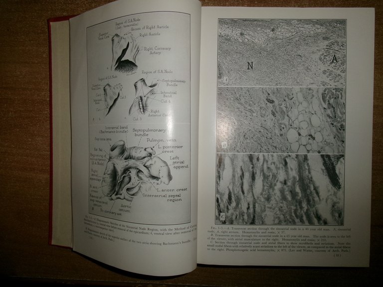 SAMUEL BELLET. Clinical Disorders of the HEART BEAT 1963