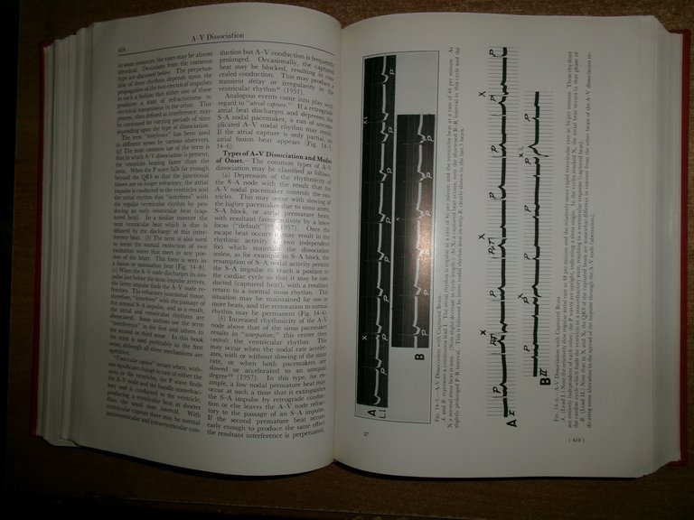 SAMUEL BELLET. Clinical Disorders of the HEART BEAT 1963
