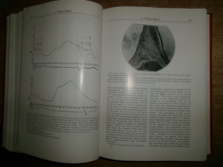 SAMUEL BELLET. Clinical Disorders of the HEART BEAT 1963