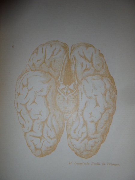 Schemata Zum Einzeichnen von Befunden bei. (Anatomia cerebrale)