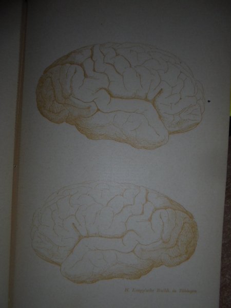 Schemata Zum Einzeichnen von Befunden bei. (Anatomia cerebrale)