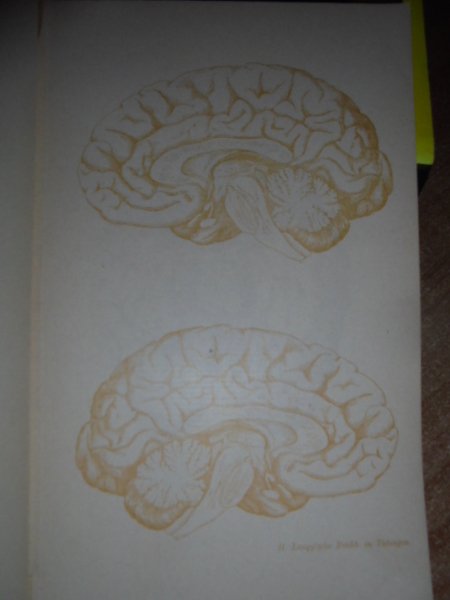 Schemata Zum Einzeichnen von Befunden bei. (Anatomia cerebrale)