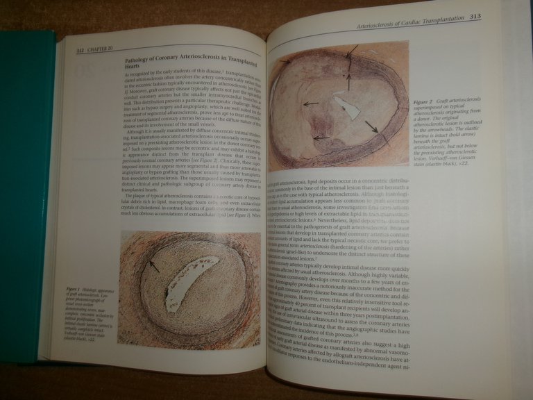 Scientific American. Molecular Cardiovascular Medicine. EDGAR HABER 1995