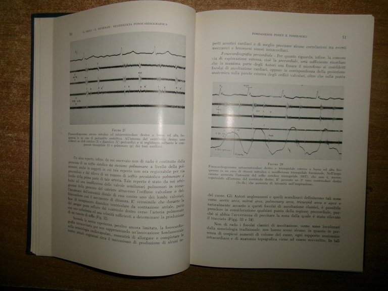 Semeiologia Fonocardiografica. Giovanni Gigli - Giulio Muiesan 1959