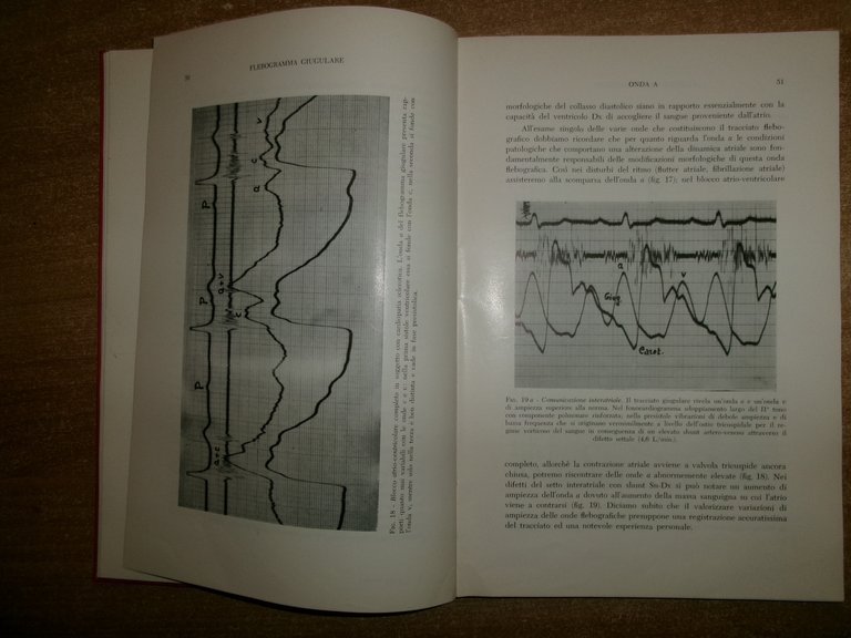 SEMEIOLOGIA POLIGRAFICA CARDIOLOGICA. CARLO FORATTINI - ENNIO ZERBINI 1961