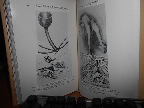 Short HISTORY OF OBSTETRICS and GYNECOLOGY