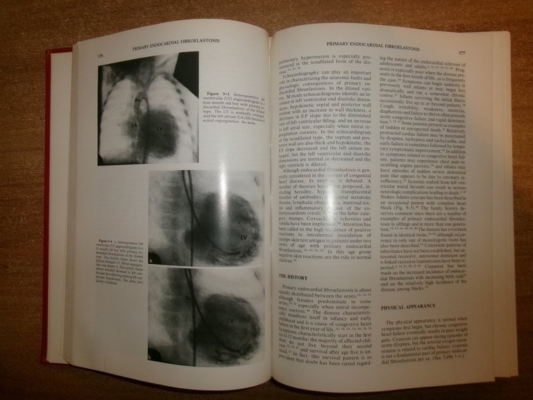 The Clinical Recognition of Congenital Heart Disease. JOSEPH PERLOFF 1978