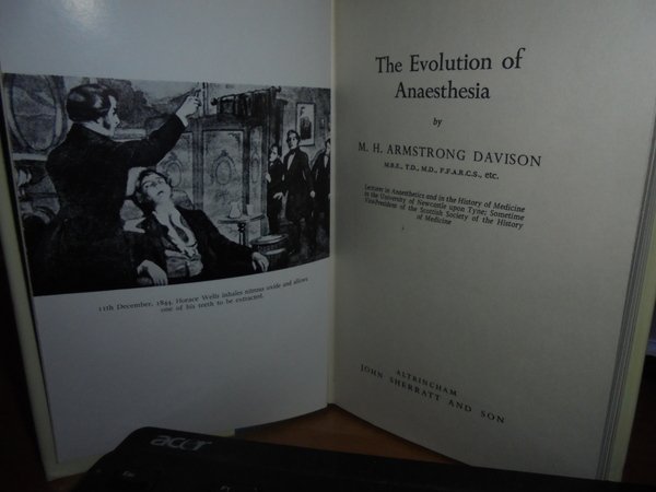 The Evolution of Anaesthesia