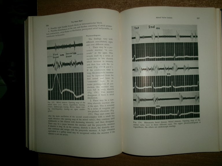 The Heart Beat. Graphic Methods in the Study of the …