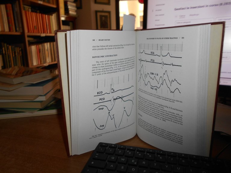 The Heart Sounds. New Facts and Their Clinical Implications. ALDO …