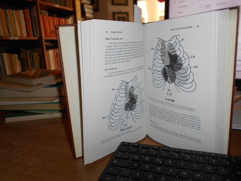 The Heart Sounds. New Facts and Their Clinical Implications. ALDO …