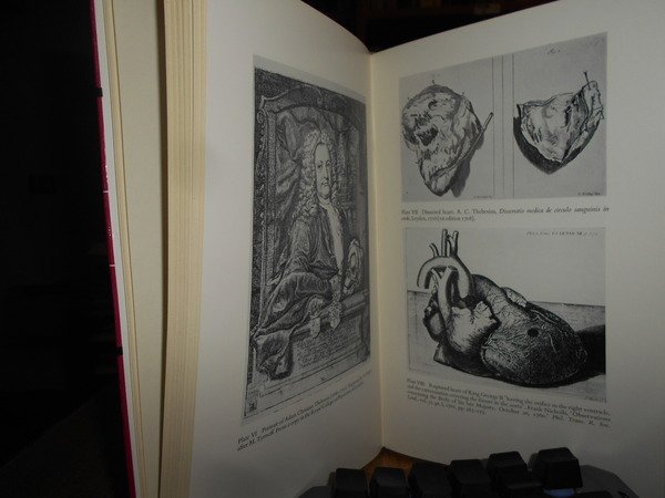 The History of Coronary Heart Disease