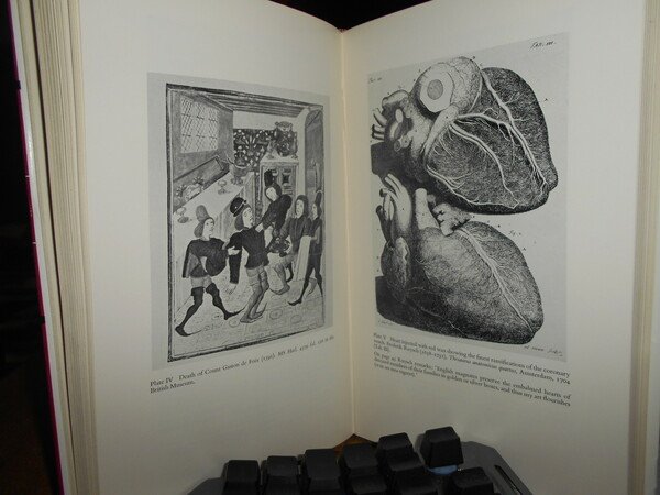 The History of Coronary Heart Disease