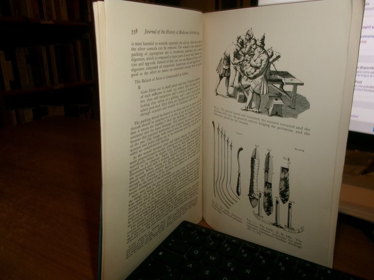 TOMMASO ALGHISI: Florentine Lithotomist (1669-1713) RALPH R. LANDES
