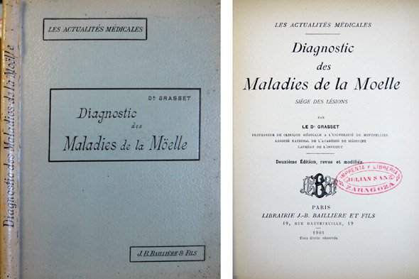 Diagnostic des Maladies de la Möelle, siège des lésions.