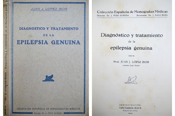 Diagnóstico y Tratamiento de la Epilepsia Genuina.