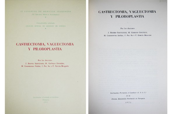 Gastrectomía, Vaguectomía y Piloroplastia.