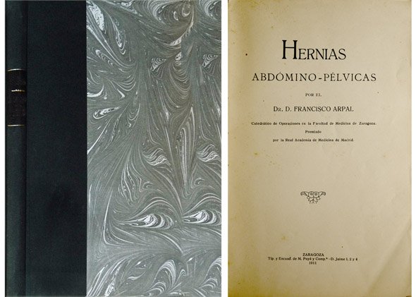 Hernias abdómico-pélvicas. | Immagine principale