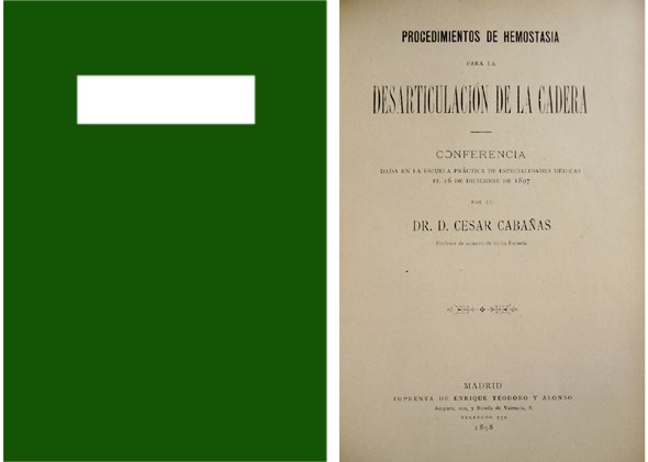 Procedimientos de hemostasia para la desarticulación de la cadera. Conferencia …