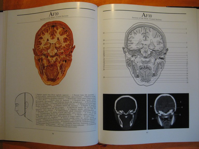 Computerized Axial Tomography: An Anatomic Atlas of Serial Sections of …