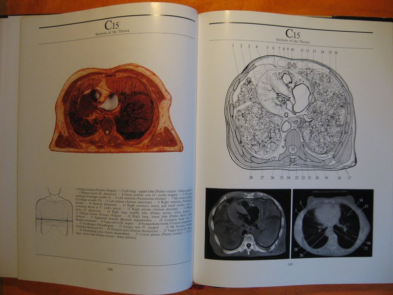 Computerized Axial Tomography: An Anatomic Atlas of Serial Sections of …