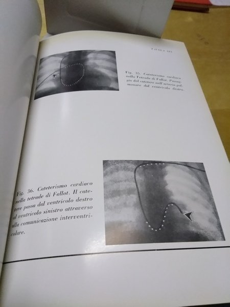 atlante di chirurgia cardiaca giorgio de poli leonardo caldarola theo …