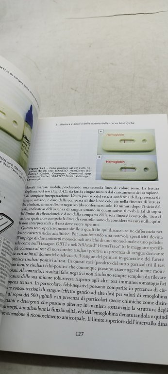 analisi delle macchie di sangue sulla scena del crimine