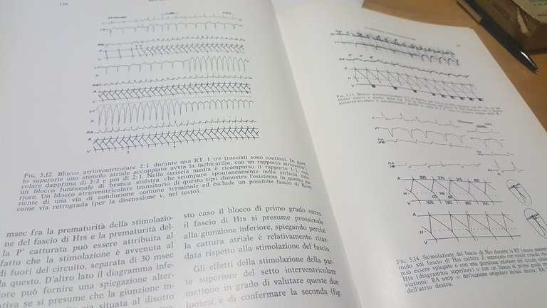 aritmie cardiache studio elettrofisiologico moderno