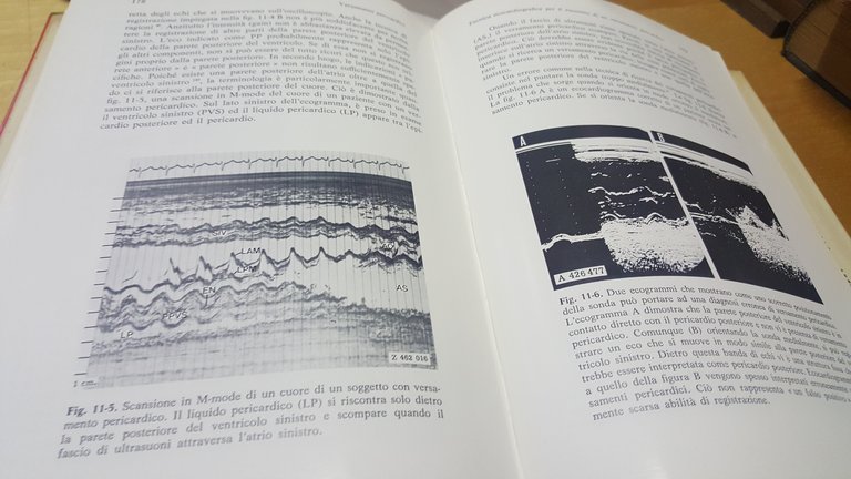 ecocardiografia feigenbaum piccin editore