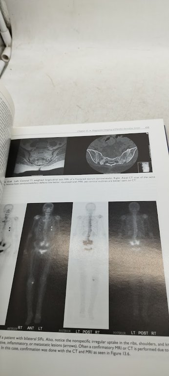 ispine evidence based interventional spine care