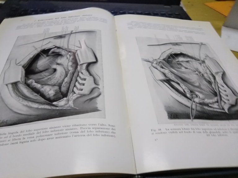 le resezioni polmonari del prf .dr. a lezius abruzzini editore …