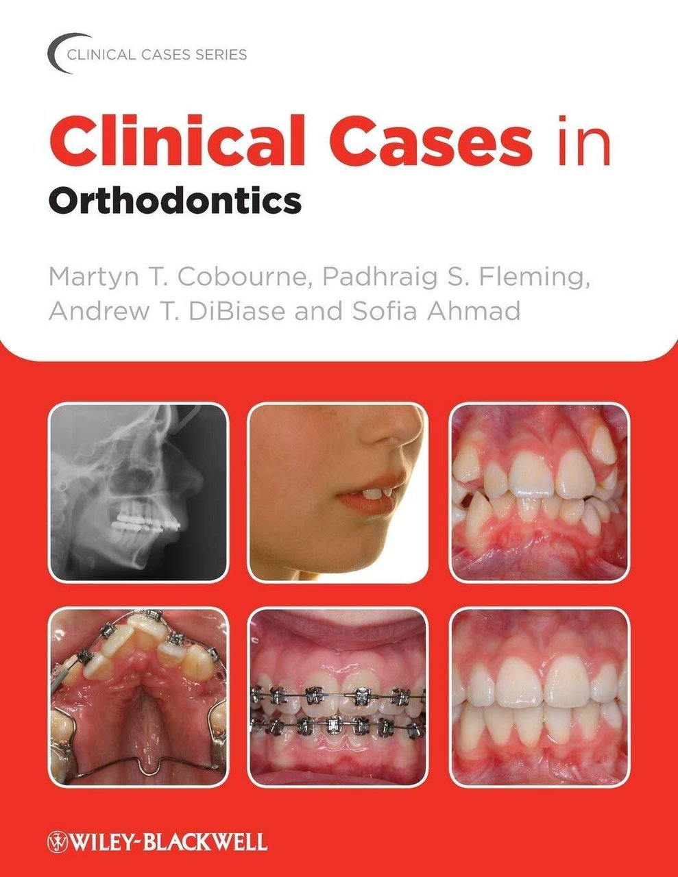 Clinical Cases in Orthodontics - Wiley John + Sons - …