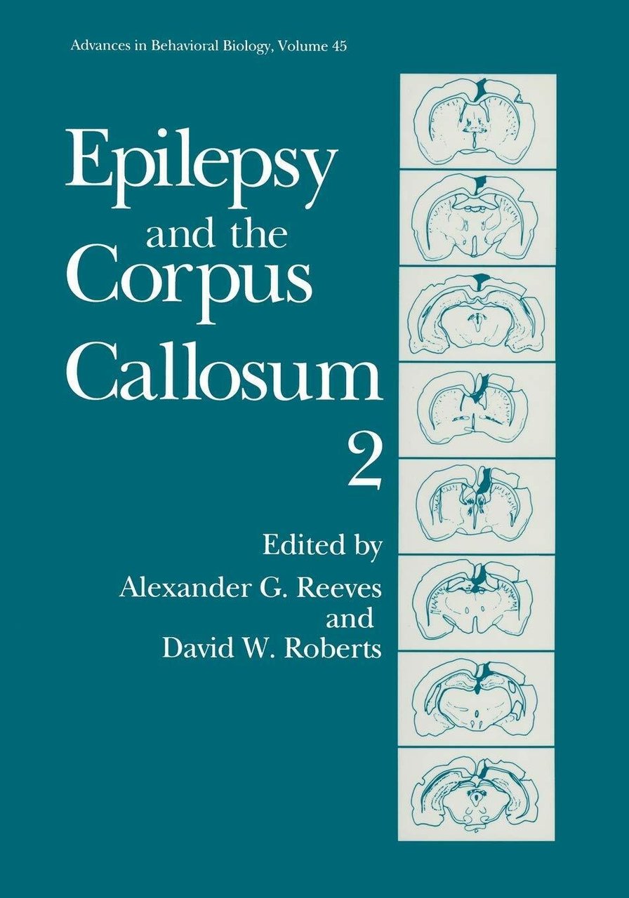 Epilepsy and the Corpus Callosum 2 - Alexander Reeves - …