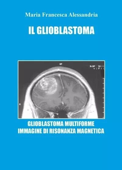Il Glioblastoma di Maria Francesca Alessandria, 2023, Youcanprint | Immagine principale