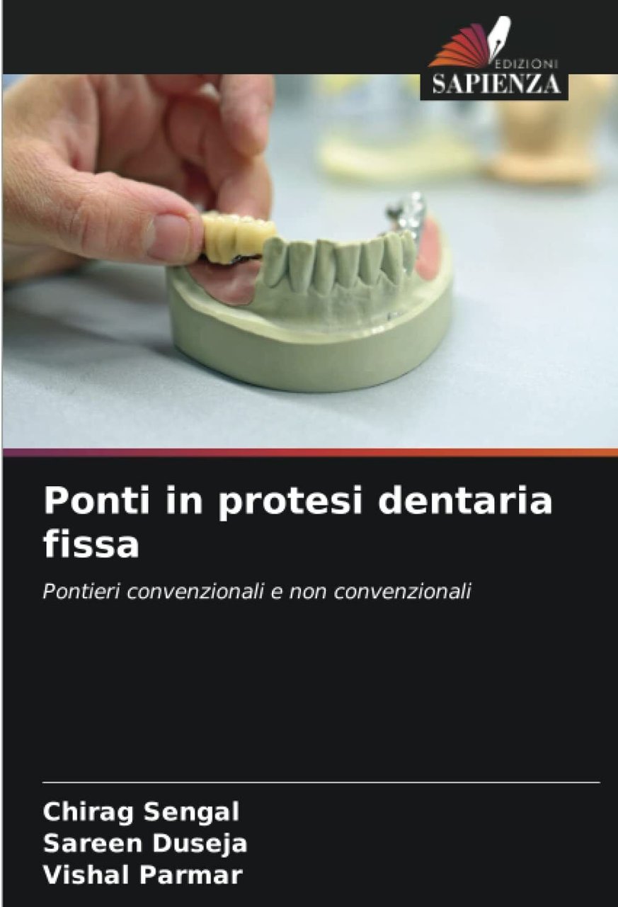 Ponti in protesi dentaria fissa - Chirag Sengal, Sareen Duseja …