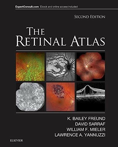 The Retinal Atlas - Elsevier - 2016