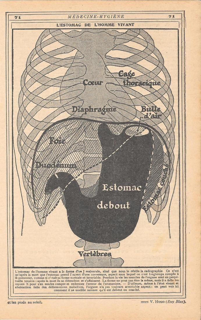 L'estomac de l'homme vivant. Stampa 1923