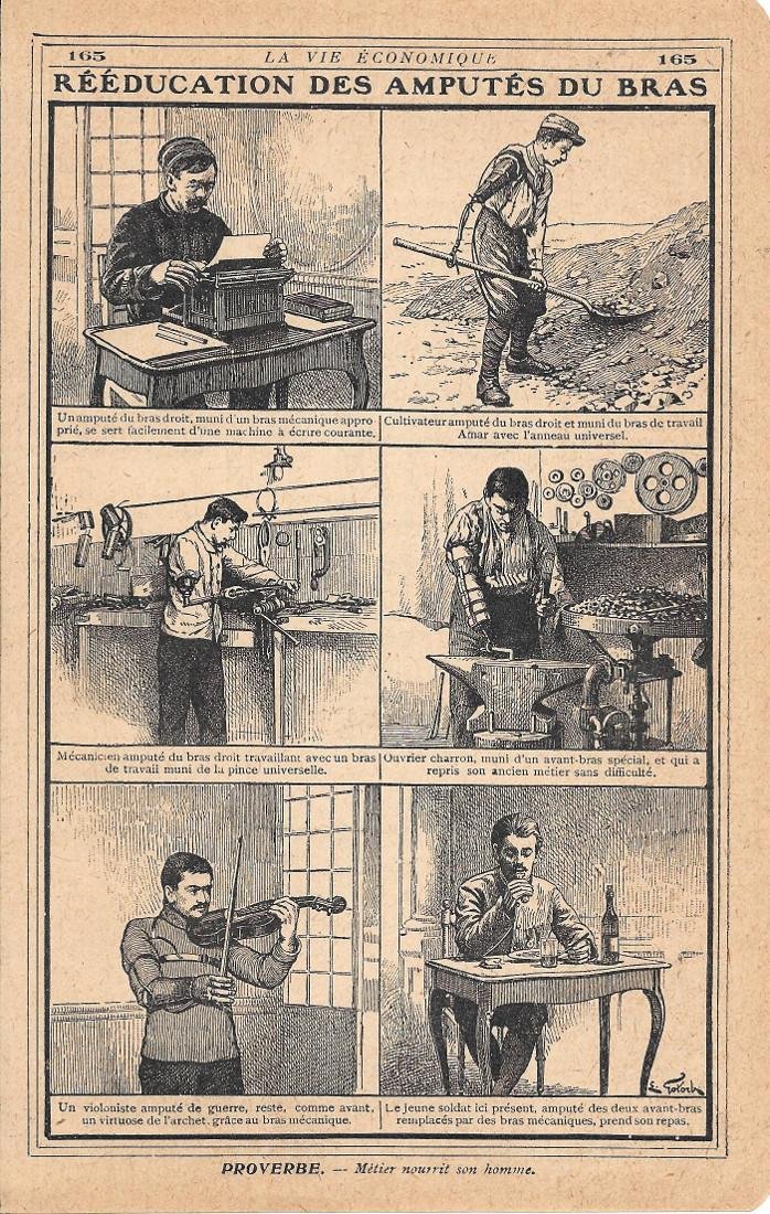 Rééducation des amputès du bras. Stampa 1919