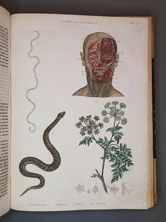 La Medicina Pittoresca o Museo Medico-Chirurgico