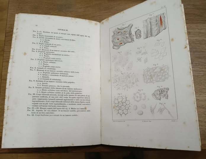 Fisiologia patologica ovvero Ricerche cliniche, sperimentali e microscopiche su la … | Immagine Gallery 3