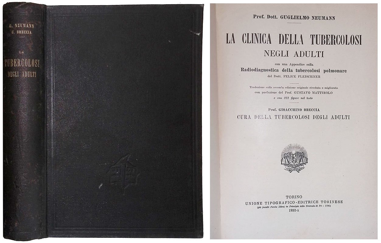 La clinica della tubercolosi negli adulti. Con una Appendice sulla …