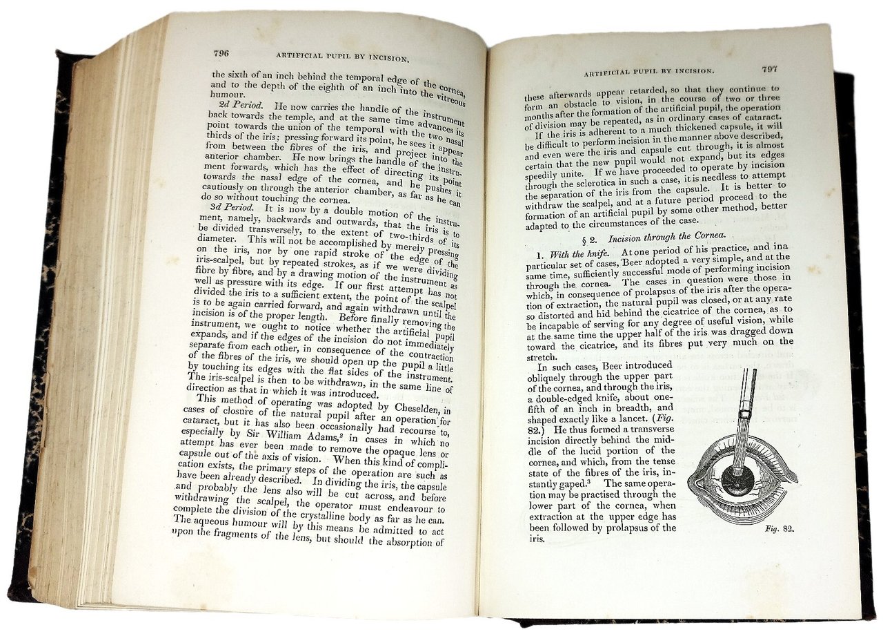 A practical treatise on the diseases of the eye.&amp;nbsp;Second edition.&amp;nbsp; | Immagine principale