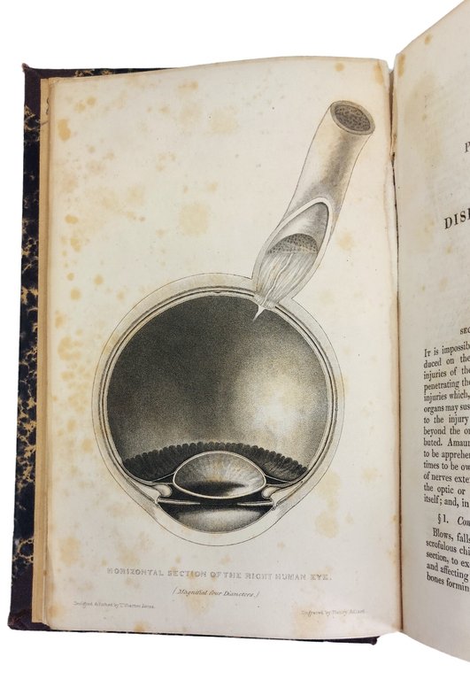 A practical treatise on the diseases of the eye.&amp;nbsp;Second edition.&amp;nbsp; | Immagine Gallery 3