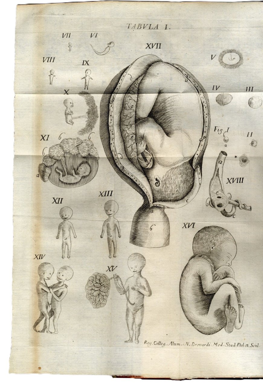 De Naturali in Humano Corpore, vitiosa morbosaque generatione historia... | Immagine principale
