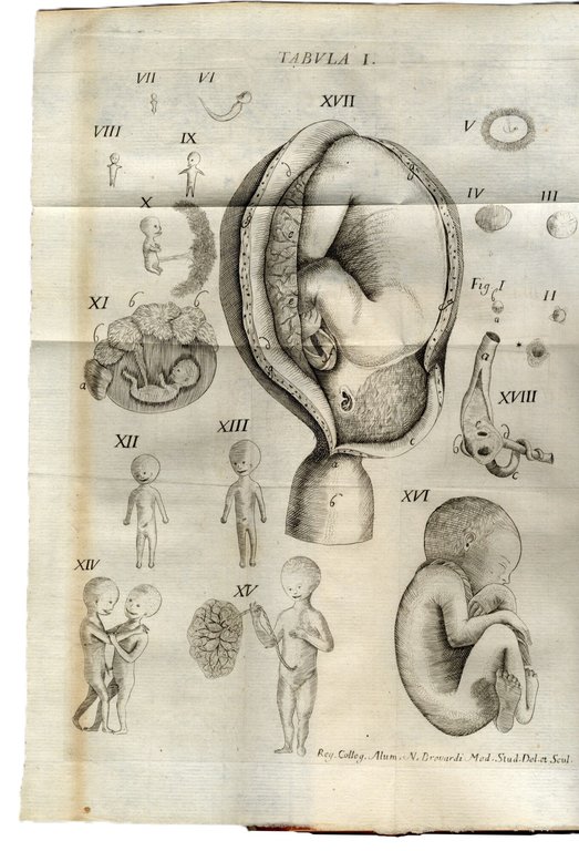 De Naturali in Humano Corpore, vitiosa morbosaque generatione historia... | Immagine Gallery 1