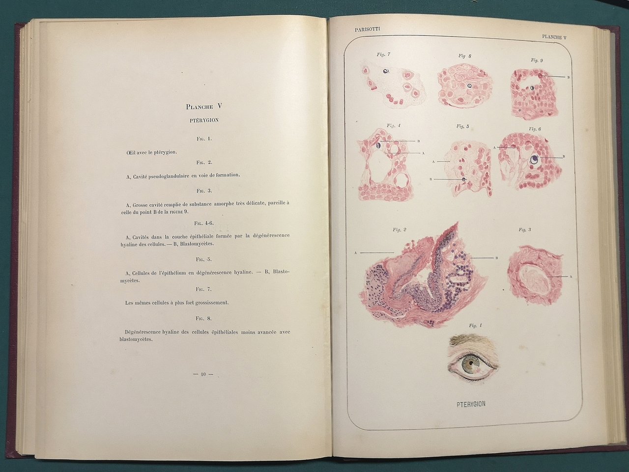 Histologie pathologique de l'oeil. Avec 20 planches dessinées d'après nature.
