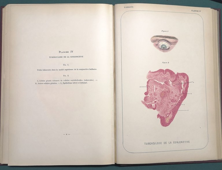 Histologie pathologique de l'oeil. Avec 20 planches dessinées d'après nature.